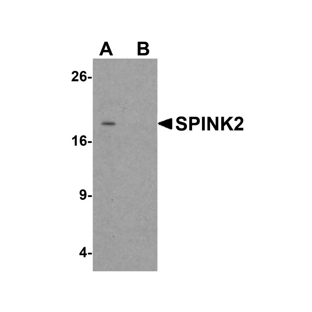 ProSci 6667 SPINK2 Antibody, ProSci, 0.1 mg/Unit Primary Image