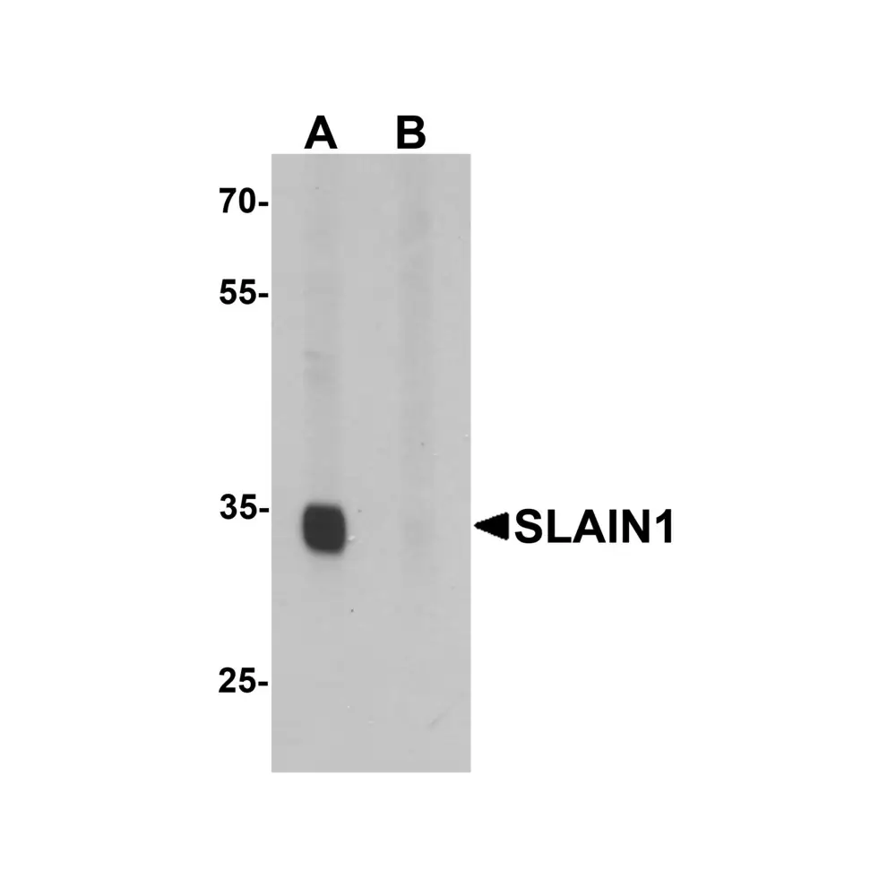ProSci 6669 SLAIN1 Antibody, ProSci, 0.1 mg/Unit Primary Image