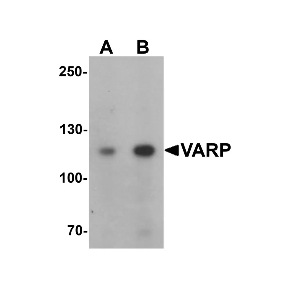 ProSci 6673 VARP Antibody, ProSci, 0.1 mg/Unit Primary Image