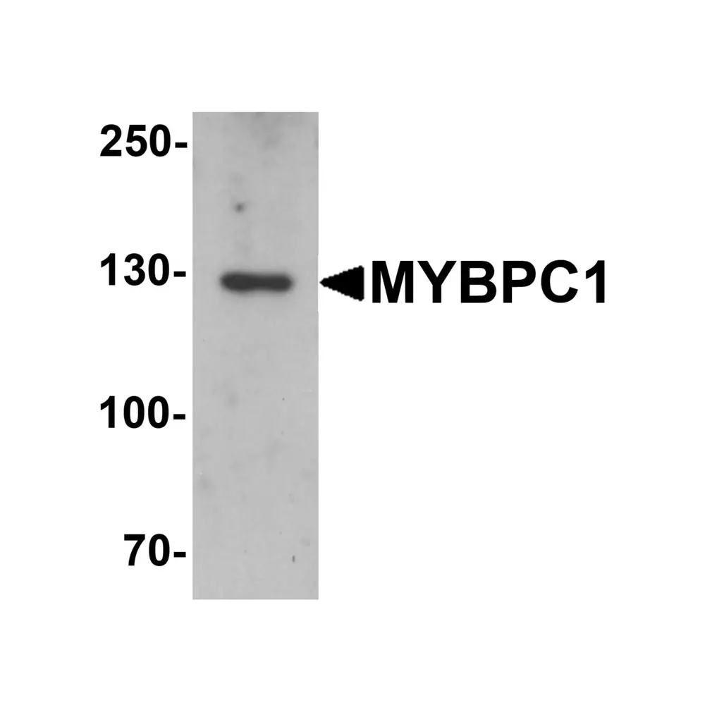 ProSci 6679 MYBPC1 Antibody, ProSci, 0.1 mg/Unit Primary Image