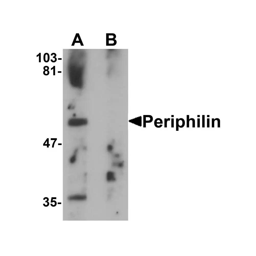 ProSci 6687 Periphilin Antibody, ProSci, 0.1 mg/Unit Primary Image