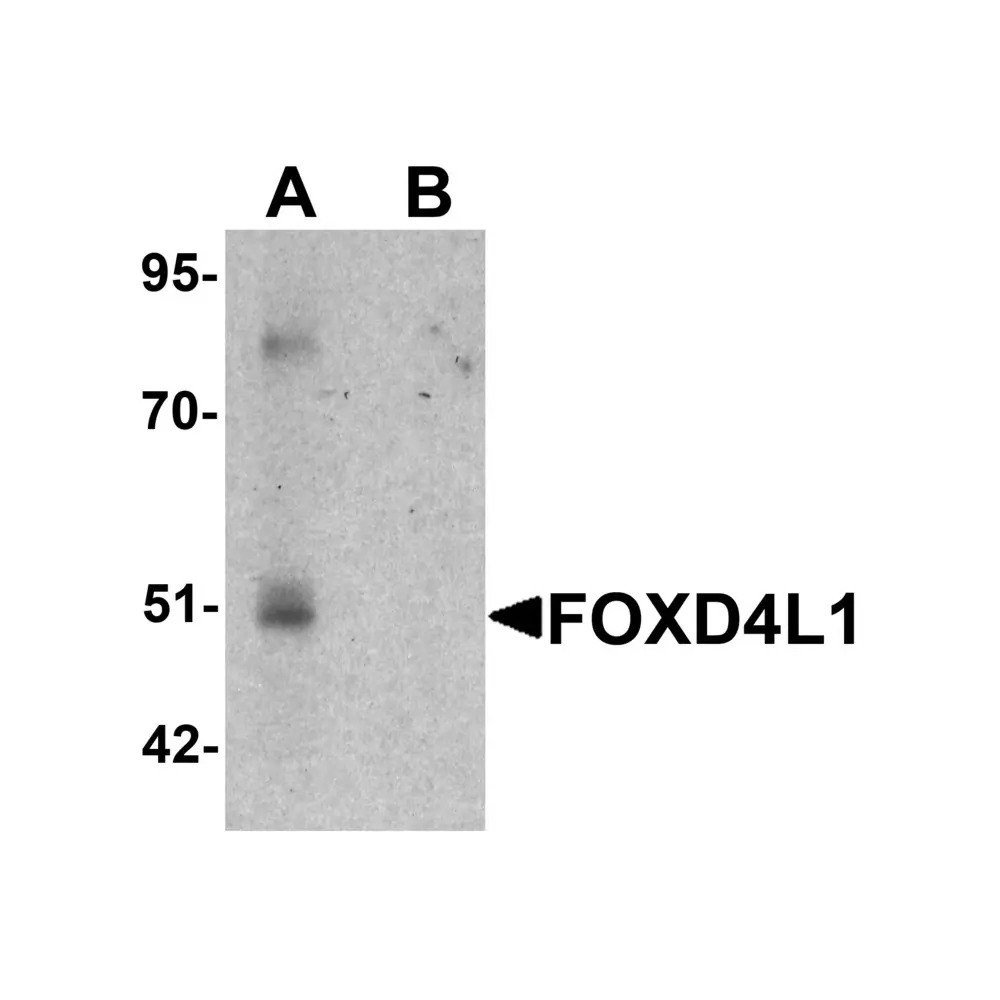 ProSci 6693_S FOXD4L1 Antibody, ProSci, 0.02 mg/Unit Primary Image