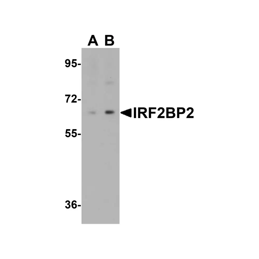 ProSci 6705 IRF2BP2 Antibody, ProSci, 0.1 mg/Unit Primary Image