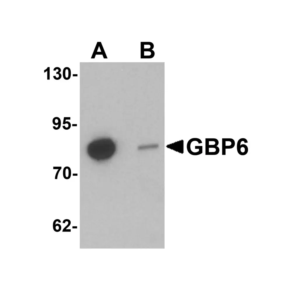 ProSci 6707 GBP6 Antibody, ProSci, 0.1 mg/Unit Primary Image