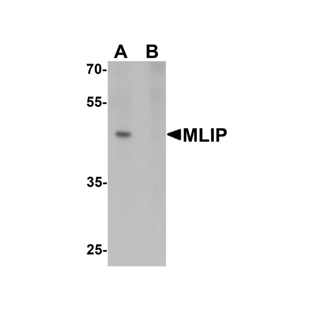 ProSci 6719 MLIP Antibody, ProSci, 0.1 mg/Unit Primary Image