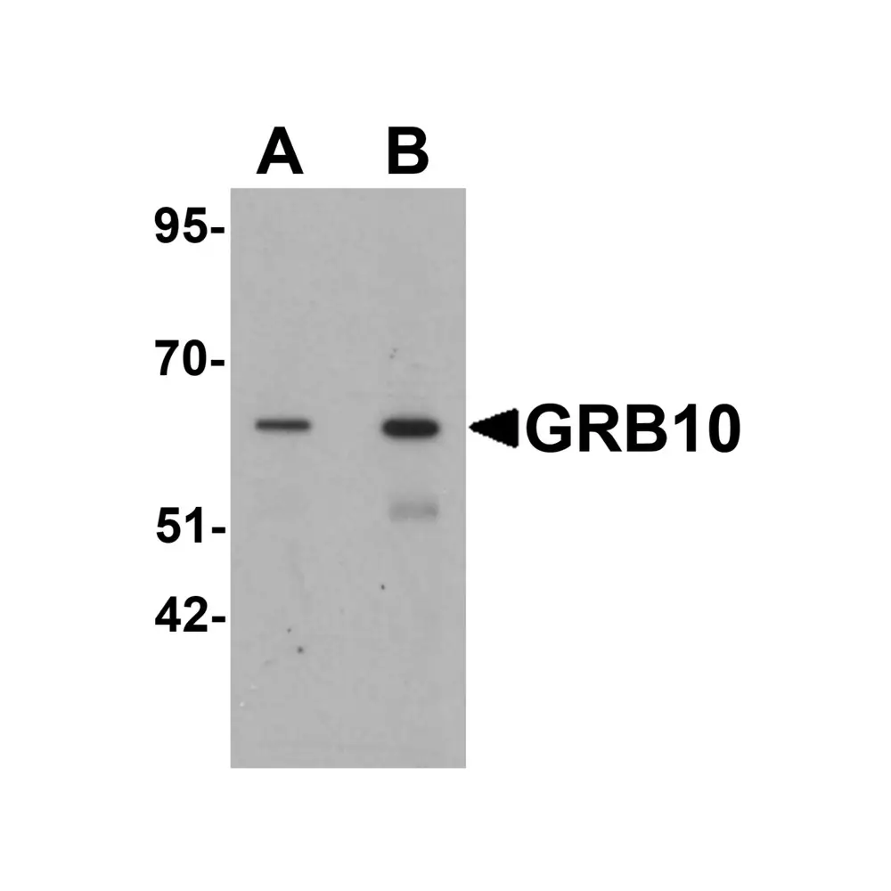 ProSci 6733 GRB10 Antibody, ProSci, 0.1 mg/Unit Primary Image
