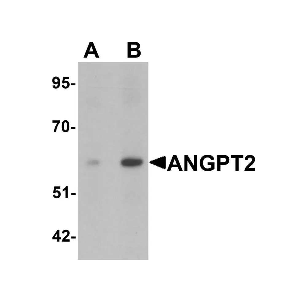 ProSci 6737 ANGPT2 Antibody, ProSci, 0.1 mg/Unit Primary Image