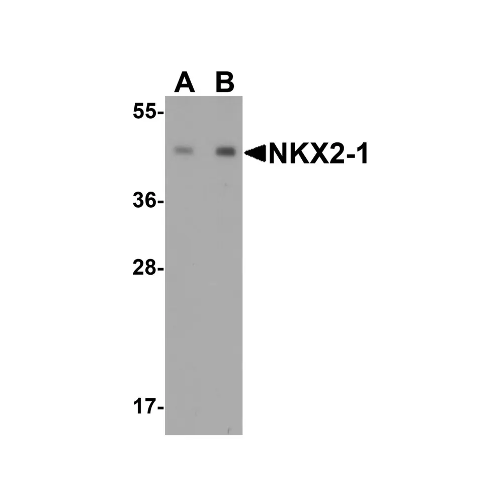 ProSci 6741 NKX2-1 Antibody, ProSci, 0.1 mg/Unit Primary Image