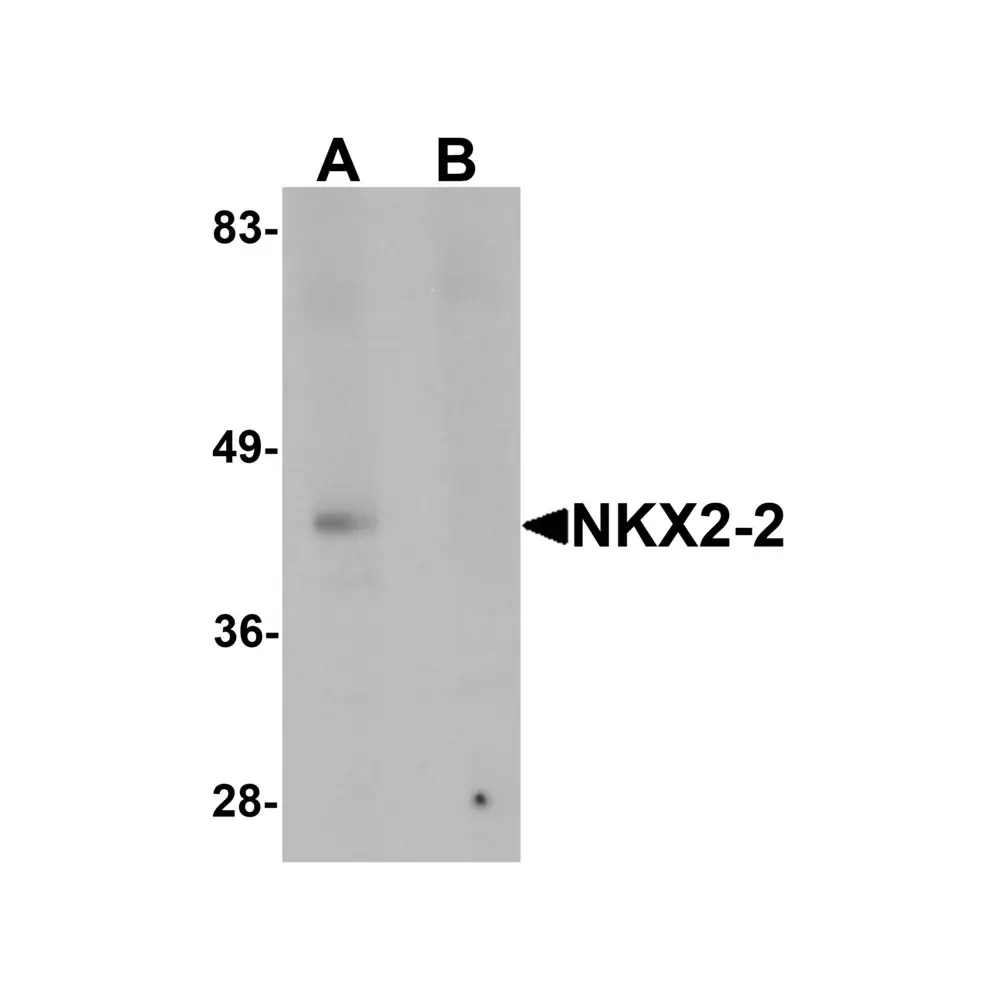 ProSci 6743_S NKX2-2 Antibody, ProSci, 0.02 mg/Unit Primary Image