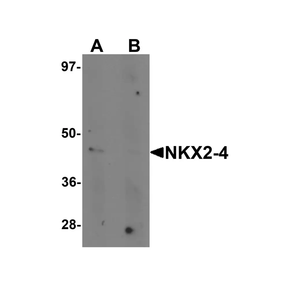 ProSci 6747 NKX2-4 Antibody, ProSci, 0.1 mg/Unit Primary Image