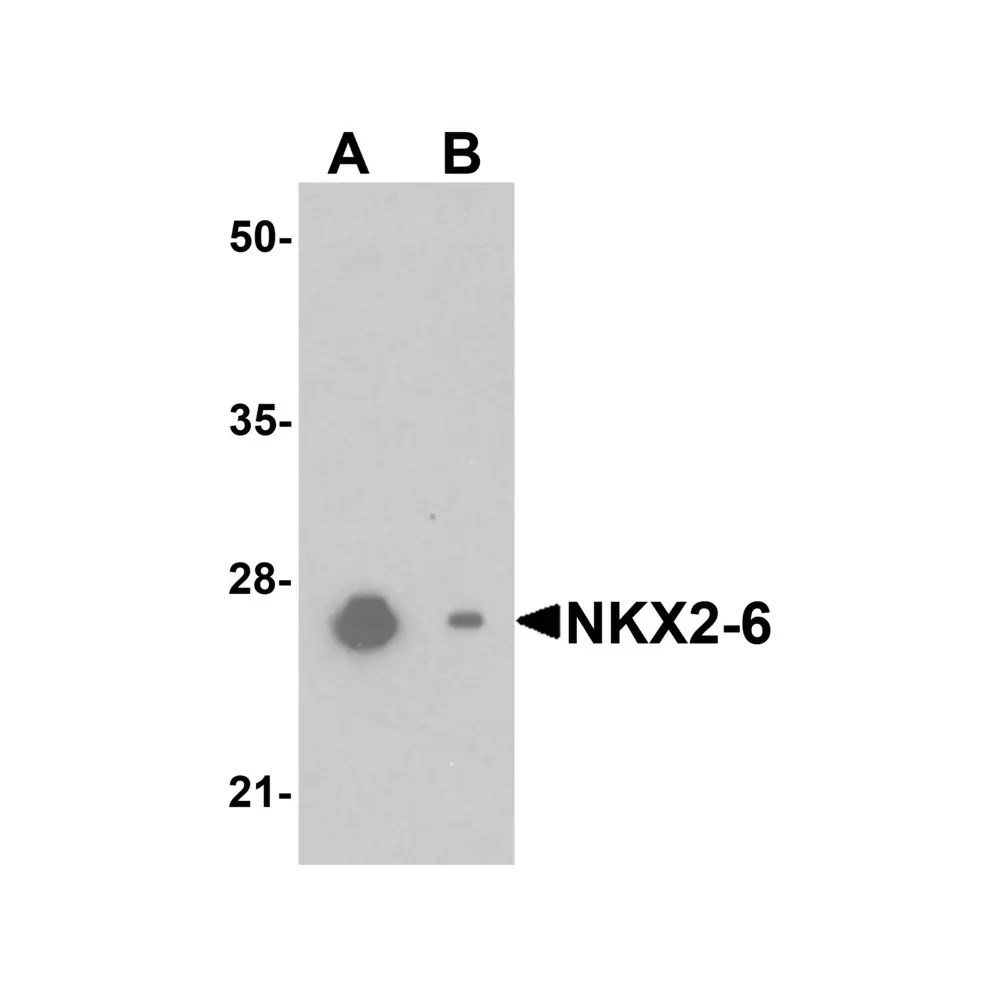 ProSci 6751 NKX2-6 Antibody, ProSci, 0.1 mg/Unit Primary Image