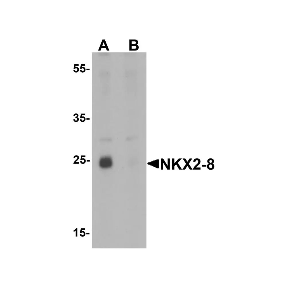ProSci 6753_S NKX2-8 Antibody, ProSci, 0.02 mg/Unit Primary Image