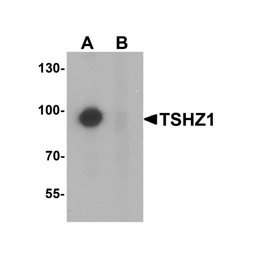 ProSci 6755 TSHZ1 Antibody, ProSci, 0.1 mg/Unit Primary Image