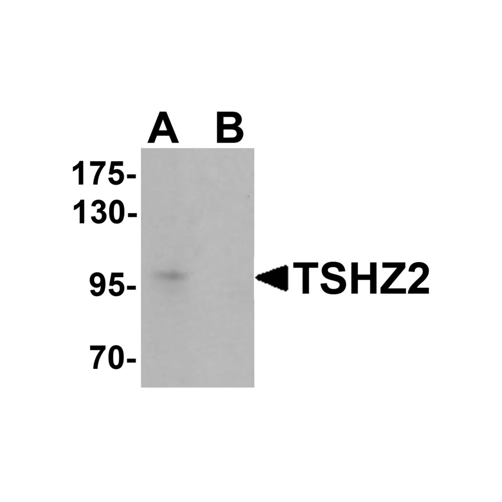 ProSci 6757 TSHZ2 Antibody, ProSci, 0.1 mg/Unit Primary Image