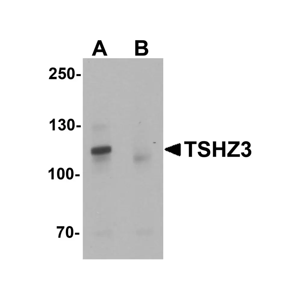 ProSci 6759 TSHZ3 Antibody, ProSci, 0.1 mg/Unit Primary Image