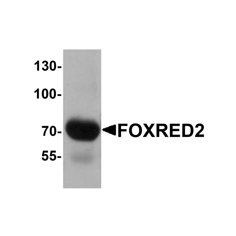 ProSci 6761 FOXRED2 Antibody, ProSci, 0.1 mg/Unit Primary Image