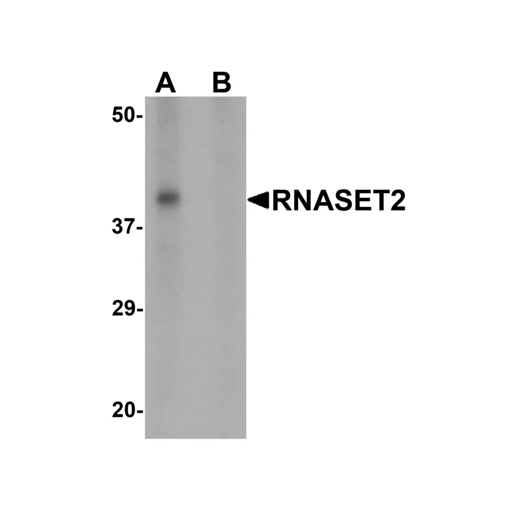 ProSci 6763_S RNASET2 Antibody, ProSci, 0.02 mg/Unit Primary Image