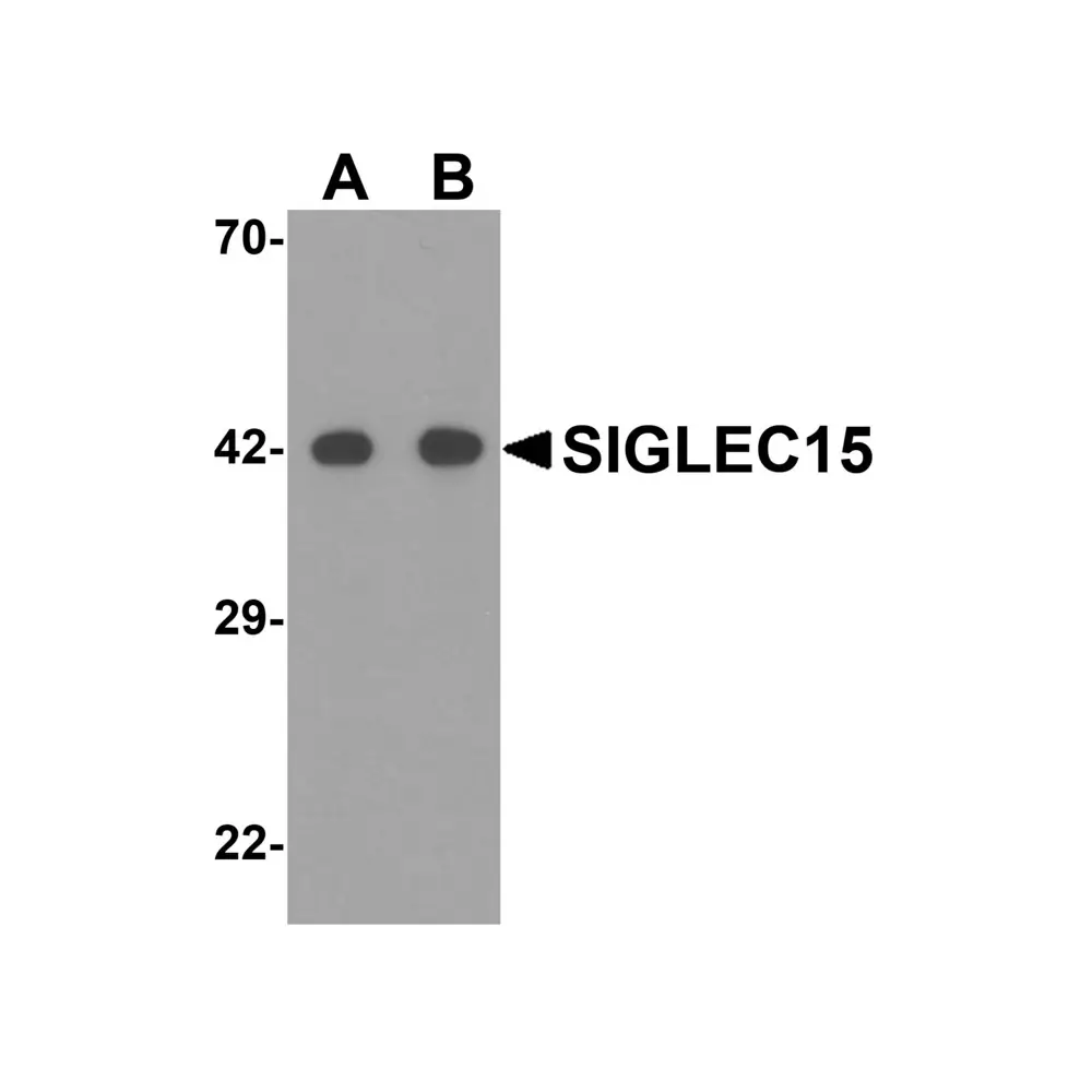 ProSci 6765_S SIGLEC15 Antibody, ProSci, 0.02 mg/Unit Primary Image