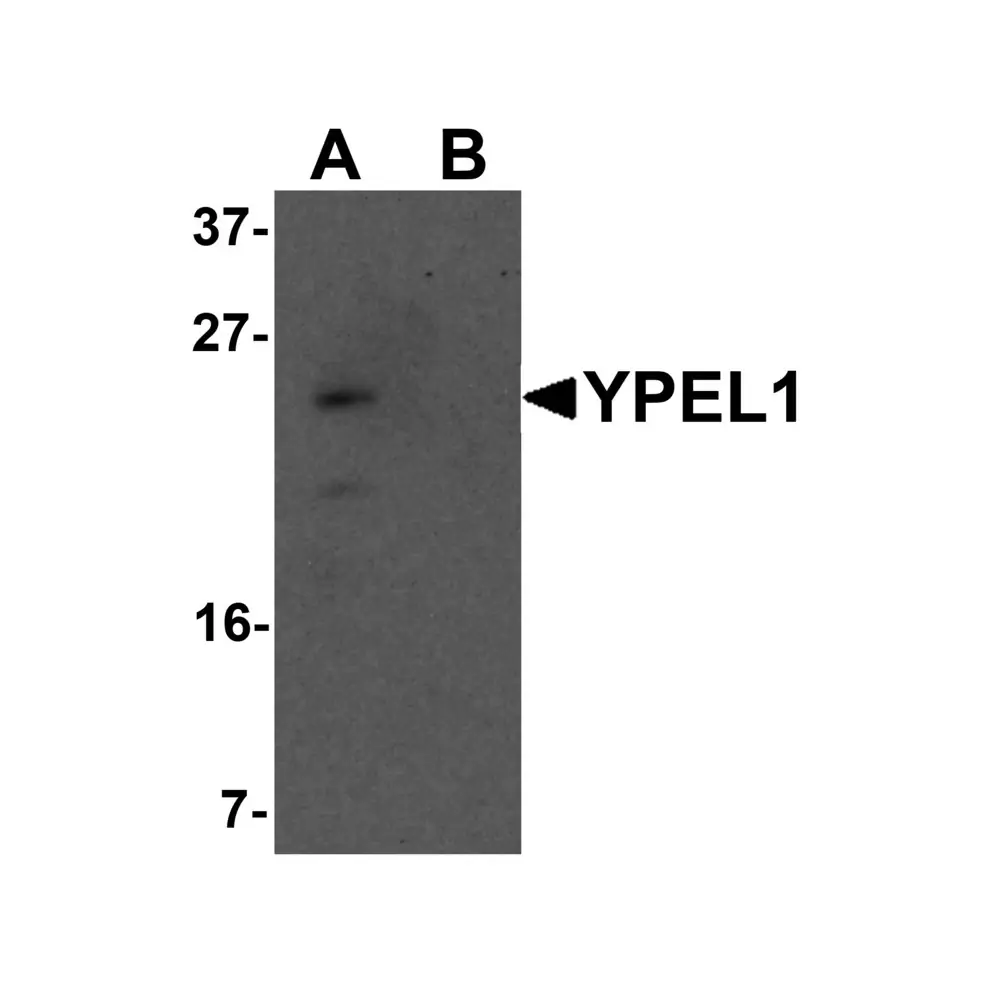 ProSci 6771 YPEL1 Antibody, ProSci, 0.1 mg/Unit Primary Image