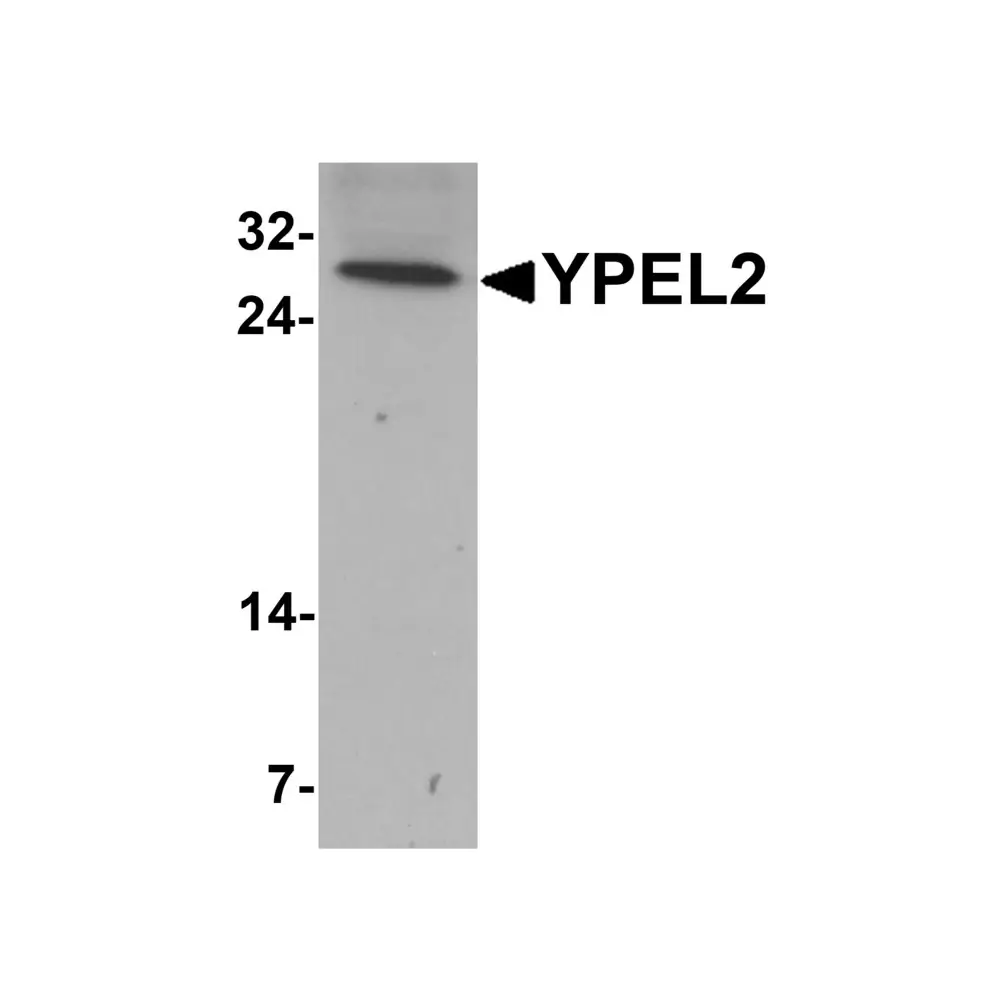ProSci 6773 YPEL2 Antibody, ProSci, 0.1 mg/Unit Primary Image