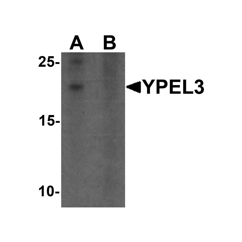 ProSci 6775_S YPEL3 Antibody, ProSci, 0.02 mg/Unit Primary Image