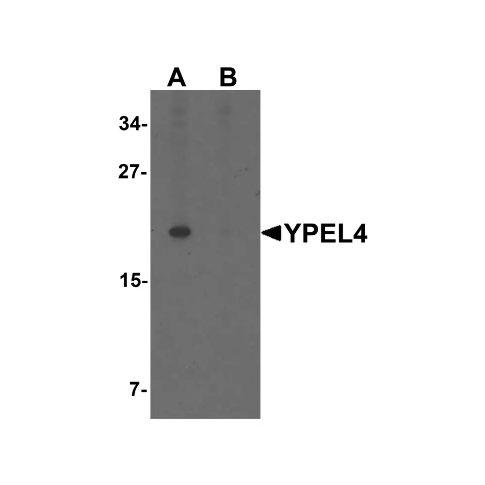 ProSci 6777 YPEL4 Antibody, ProSci, 0.1 mg/Unit Primary Image