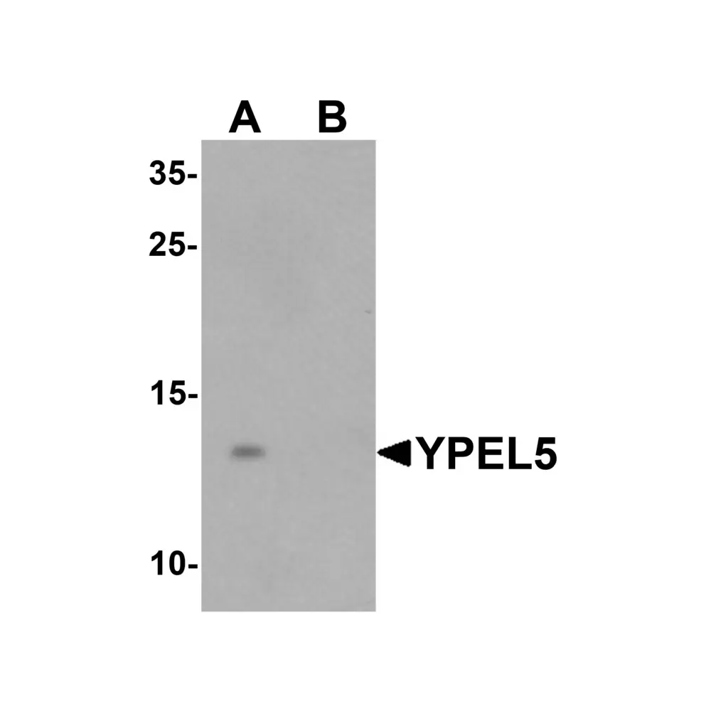 ProSci 6779_S YPEL5 Antibody, ProSci, 0.02 mg/Unit Primary Image