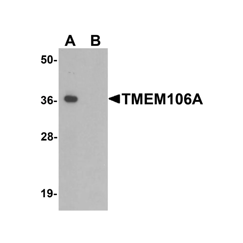 ProSci 6781 TMEM106A Antibody, ProSci, 0.1 mg/Unit Primary Image
