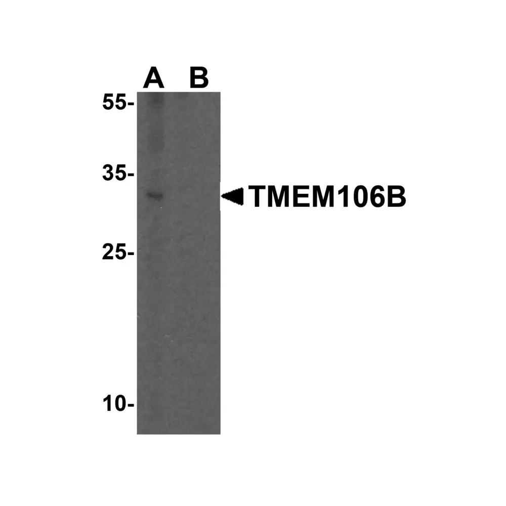 ProSci 6783 TMEM106B Antibody, ProSci, 0.1 mg/Unit Primary Image