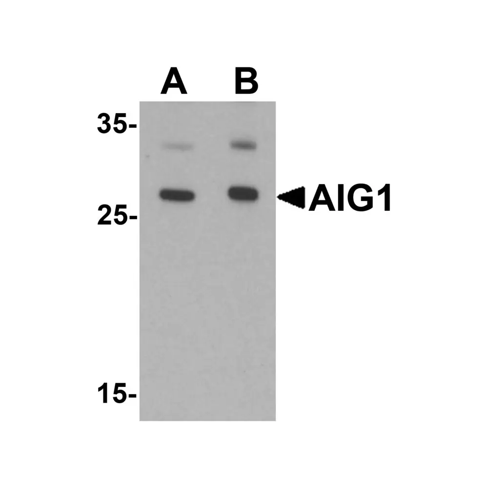 ProSci 6785 AIG1 Antibody, ProSci, 0.1 mg/Unit Primary Image