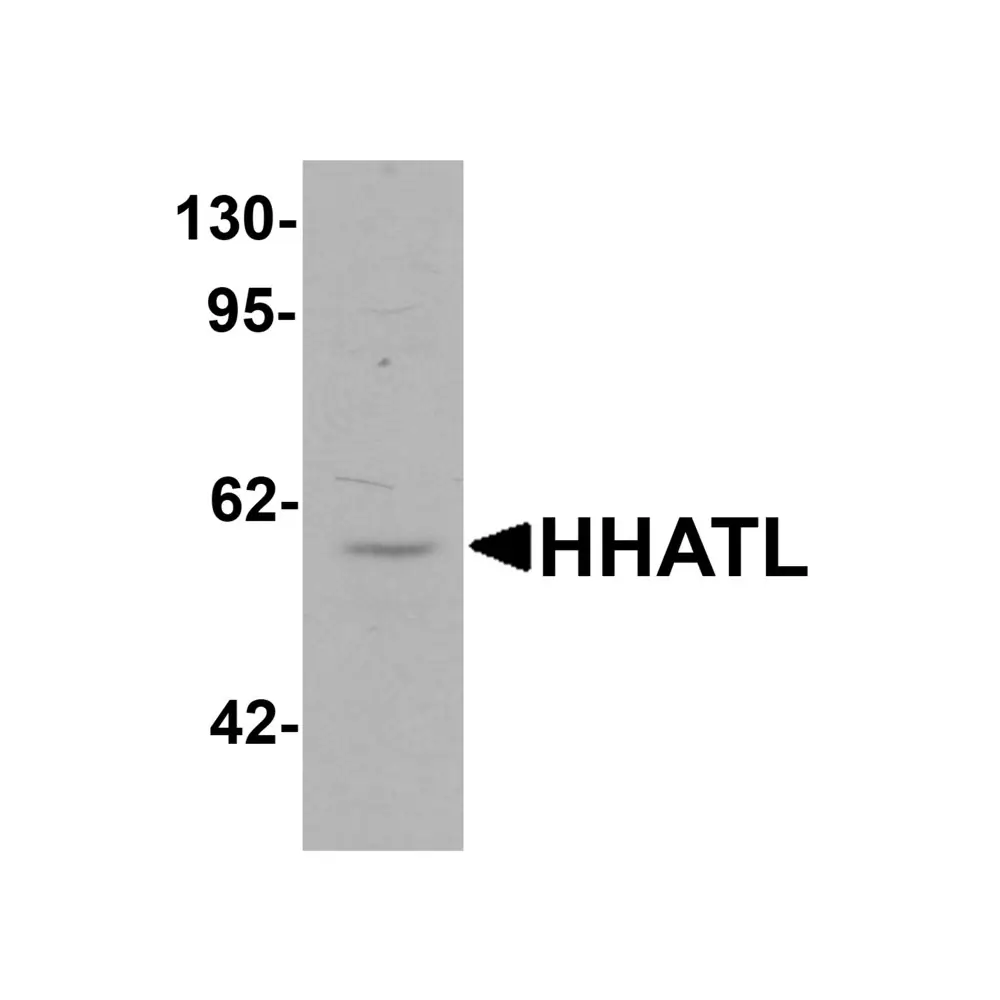 ProSci 6787 HHATL Antibody, ProSci, 0.1 mg/Unit Primary Image