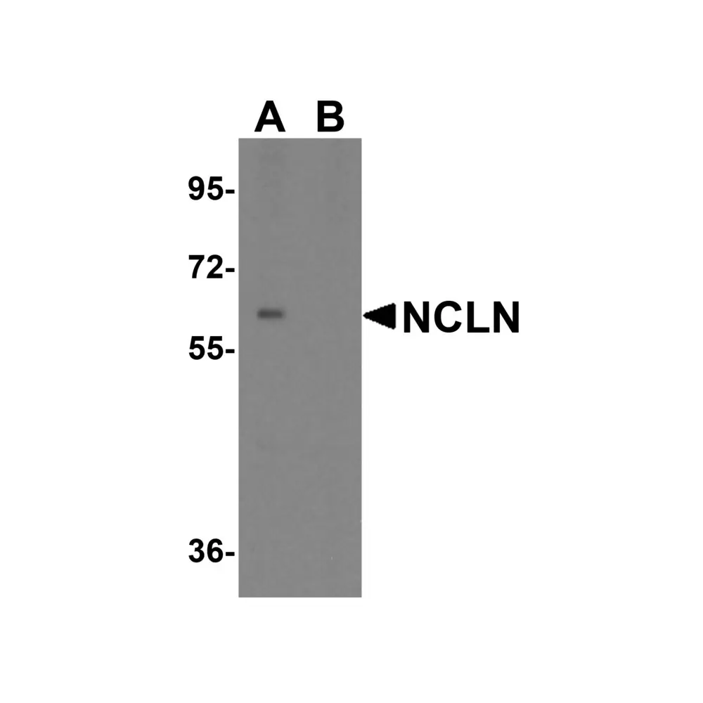 ProSci 6789_S NCLN Antibody, ProSci, 0.02 mg/Unit Primary Image