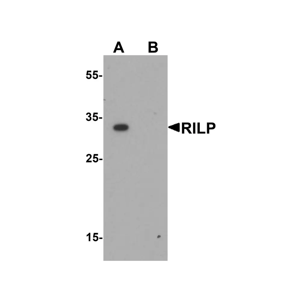 ProSci 6791_S RILP Antibody, ProSci, 0.02 mg/Unit Primary Image