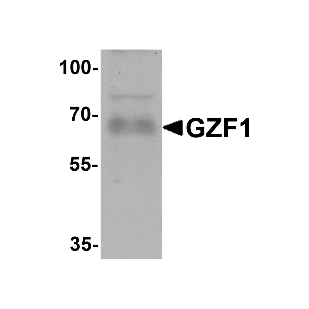 ProSci 6793 GZF1 Antibody, ProSci, 0.1 mg/Unit Primary Image