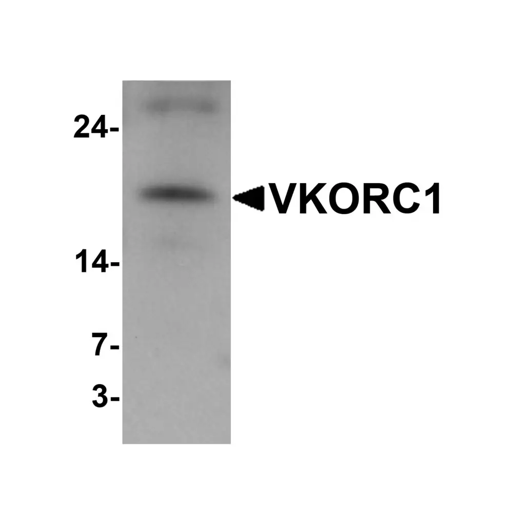 ProSci 6795 VKORC1 Antibody, ProSci, 0.1 mg/Unit Primary Image
