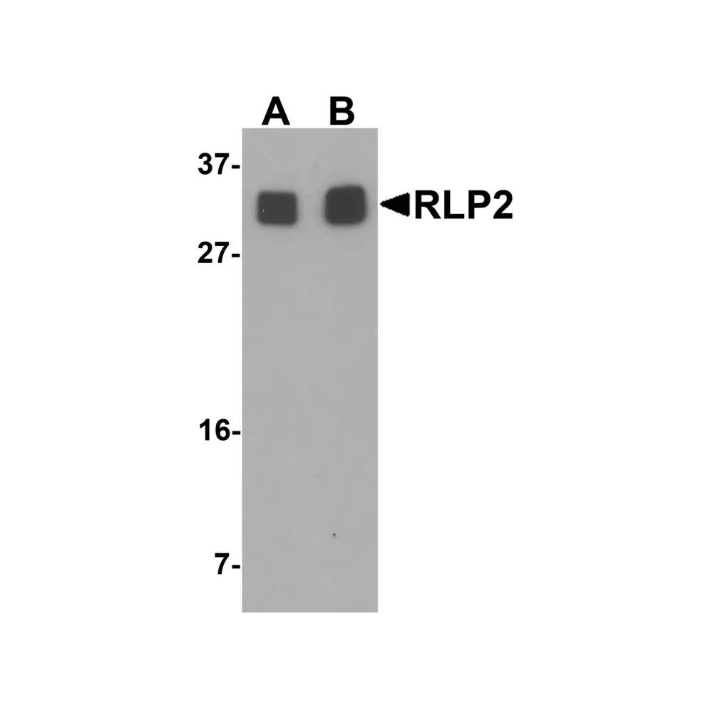 ProSci 6799 RLP2 Antibody, ProSci, 0.1 mg/Unit Primary Image