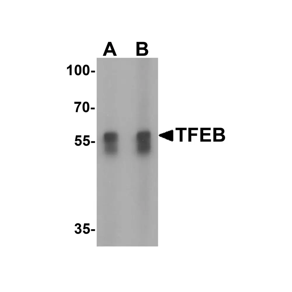 ProSci 6801 TFEB Antibody, ProSci, 0.1 mg/Unit Primary Image