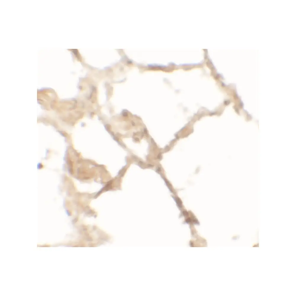 ProSci 6803 TFEB Antibody, ProSci, 0.1 mg/Unit Primary Image