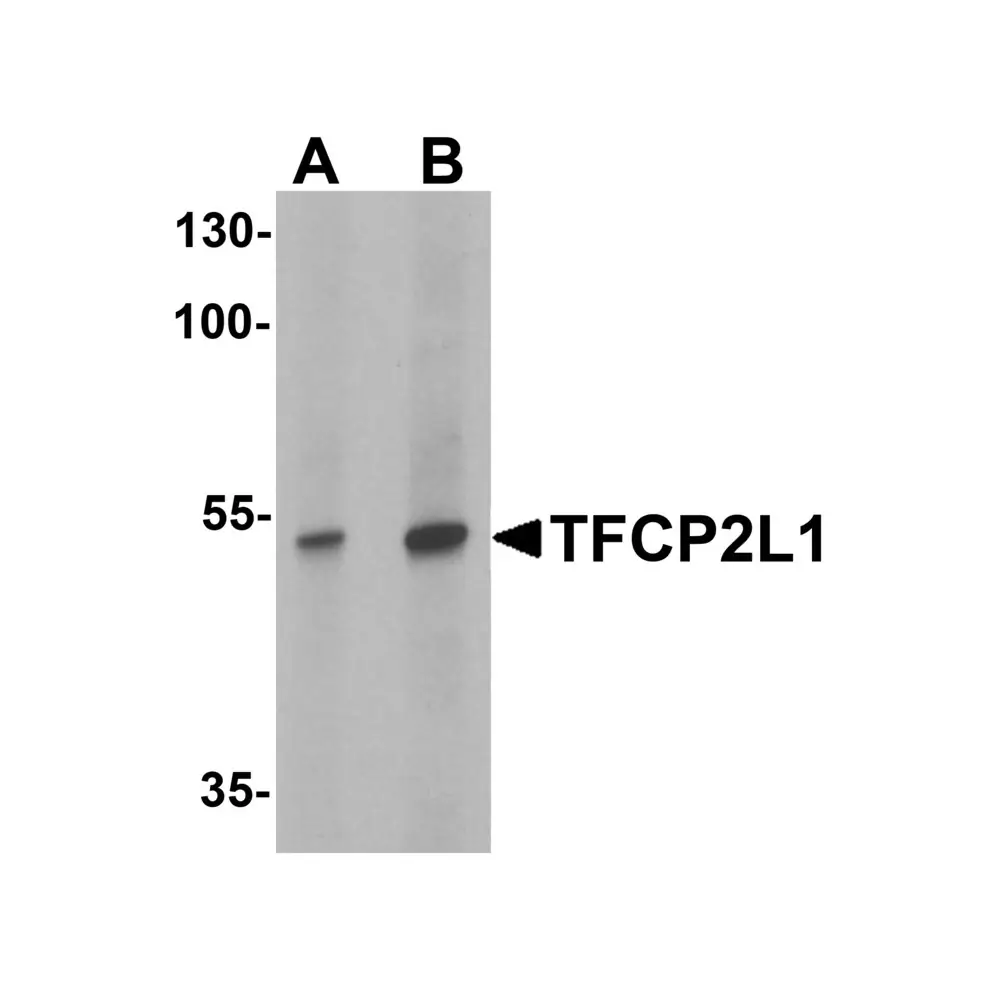 ProSci 6807 TFCP2L1 Antibody, ProSci, 0.1 mg/Unit Primary Image
