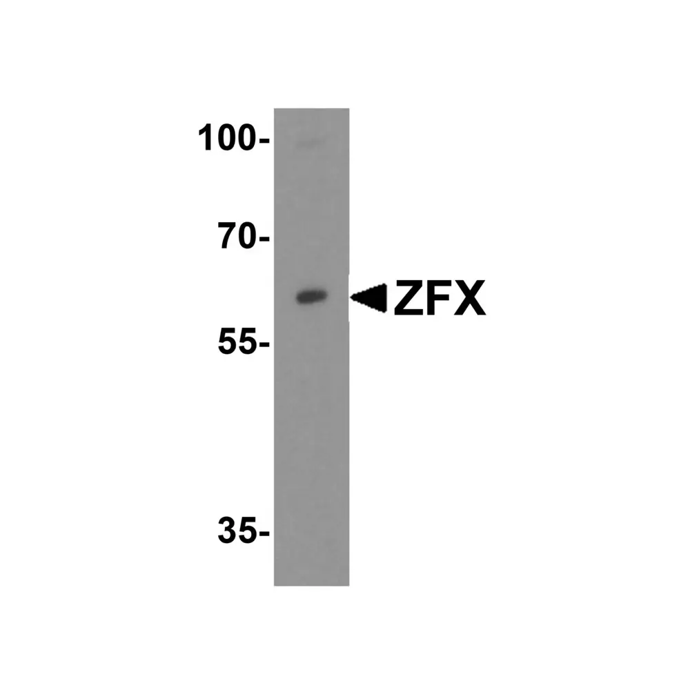 ProSci 6811_S ZFX Antibody, ProSci, 0.02 mg/Unit Primary Image