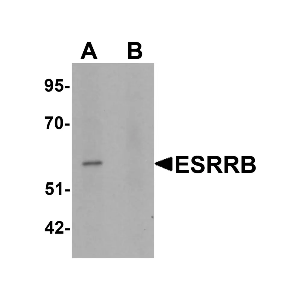 ProSci 6813 ESRRB Antibody, ProSci, 0.1 mg/Unit Primary Image
