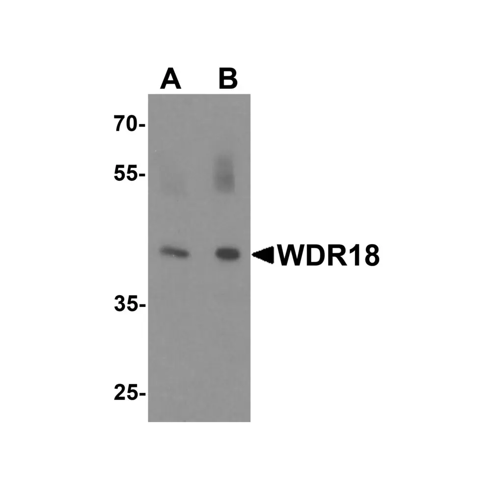 ProSci 6817 WDR18 Antibody, ProSci, 0.1 mg/Unit Primary Image