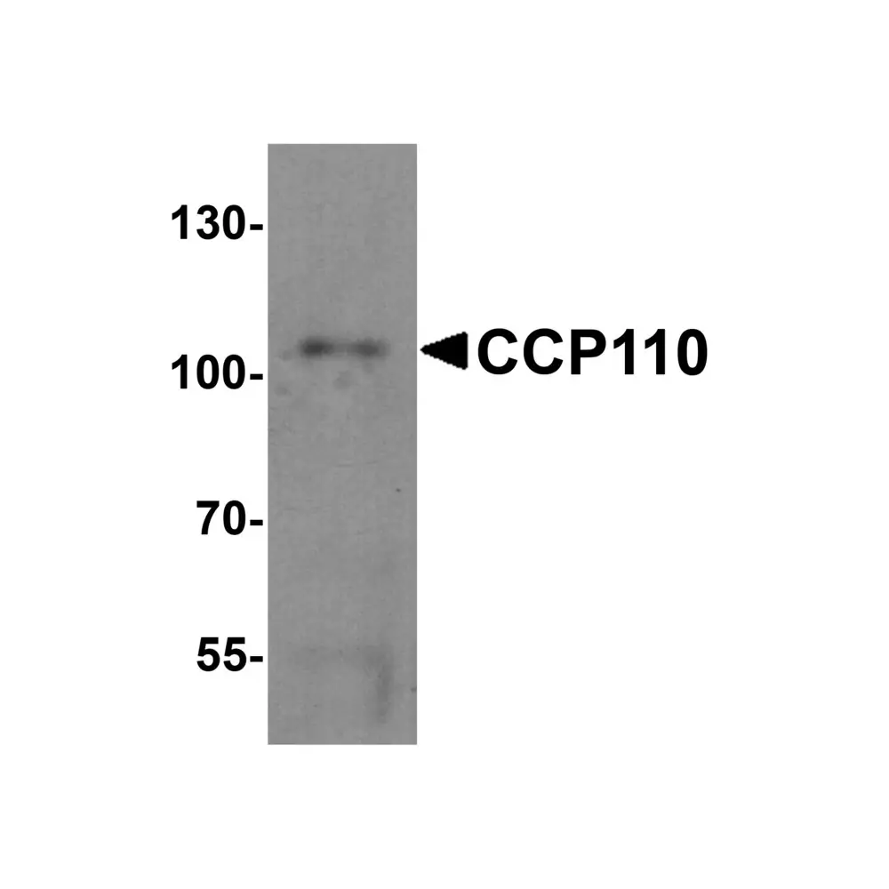 ProSci 6825 CCP110 Antibody, ProSci, 0.1 mg/Unit Primary Image