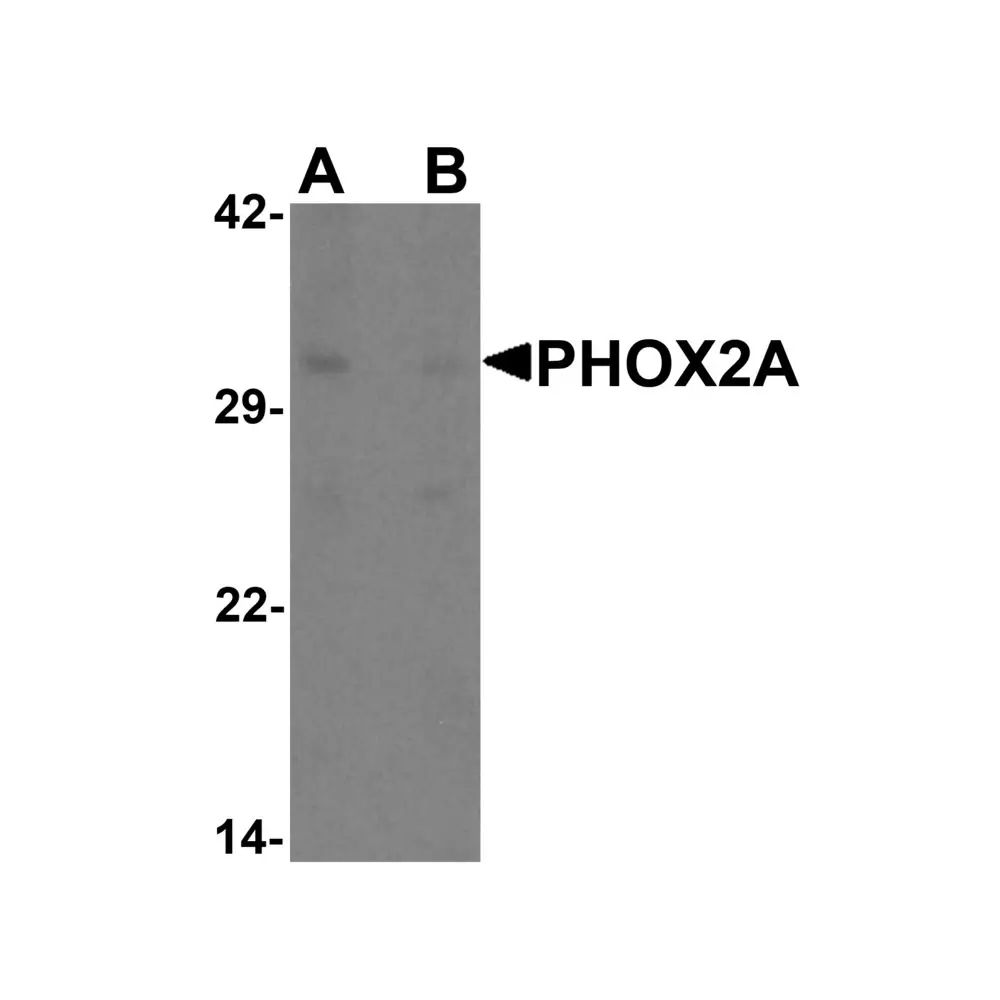 ProSci 6827_S PHOX2A Antibody, ProSci, 0.02 mg/Unit Primary Image