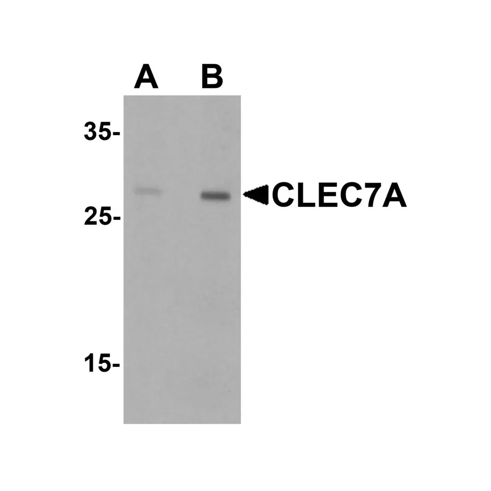 ProSci 6833 CLEC7A Antibody, ProSci, 0.1 mg/Unit Primary Image