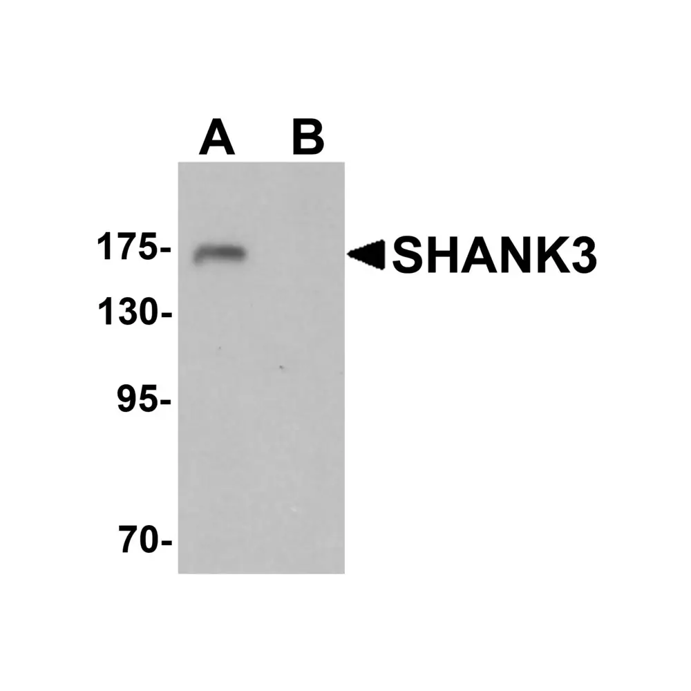 ProSci 6835_S SHANK3 Antibody, ProSci, 0.02 mg/Unit Primary Image