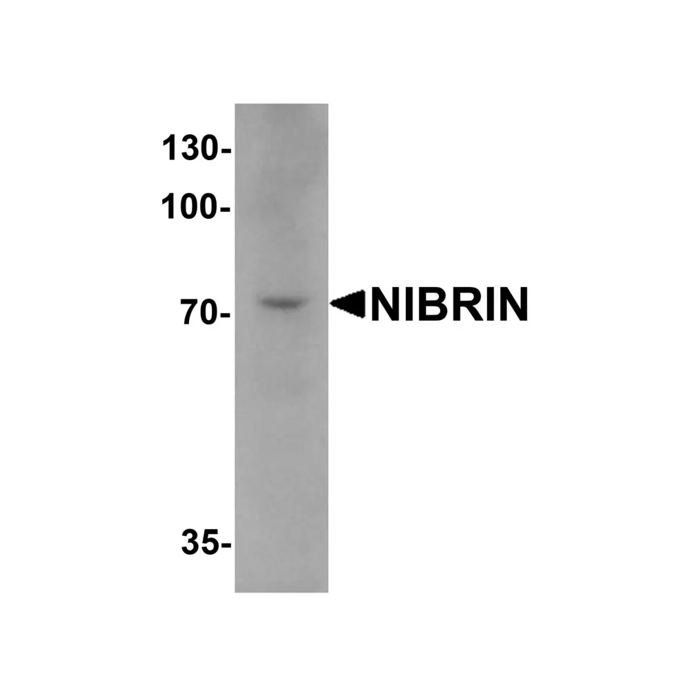 ProSci 6839_S NIBRIN Antibody, ProSci, 0.02 mg/Unit Primary Image