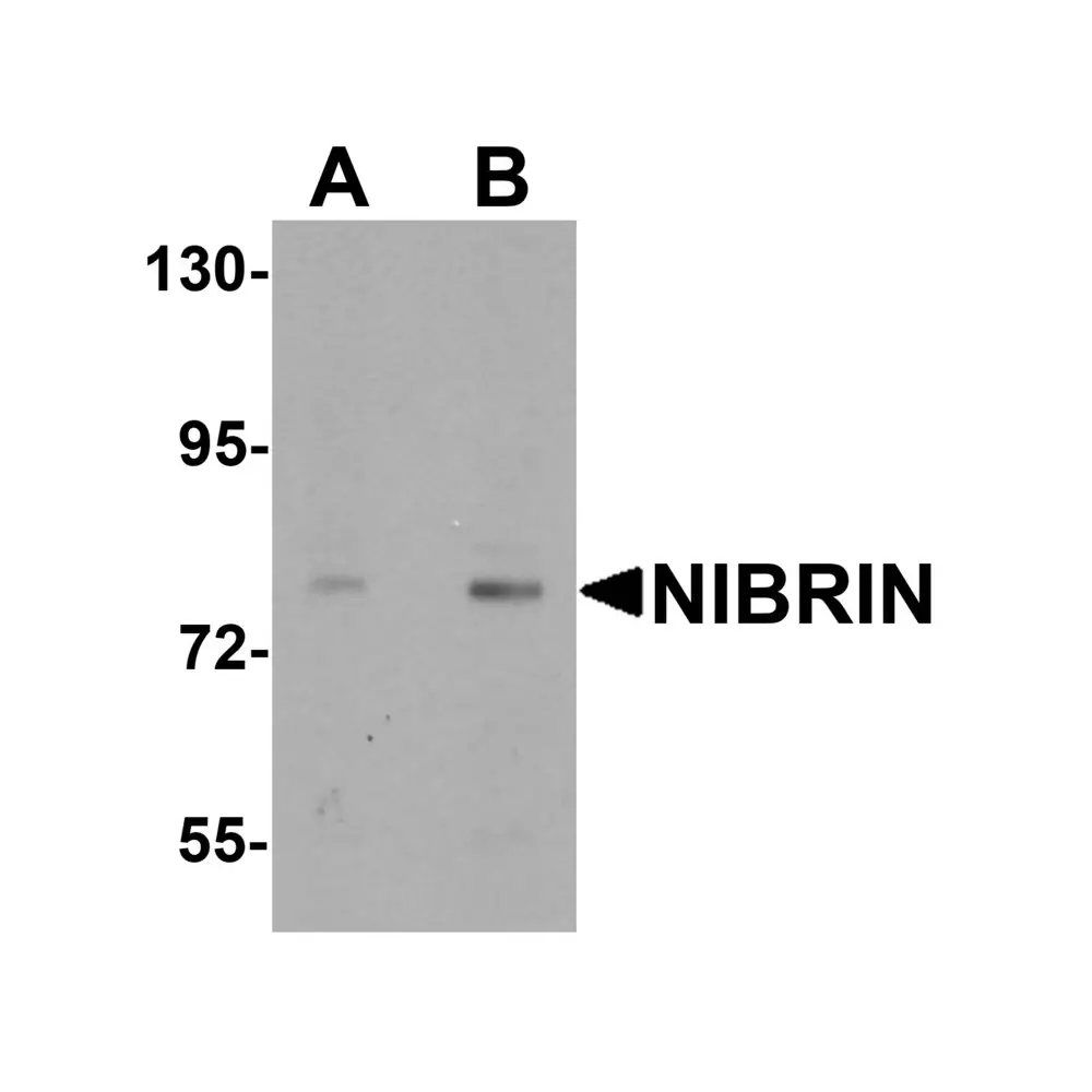 ProSci 6841 NIBRIN Antibody, ProSci, 0.1 mg/Unit Primary Image