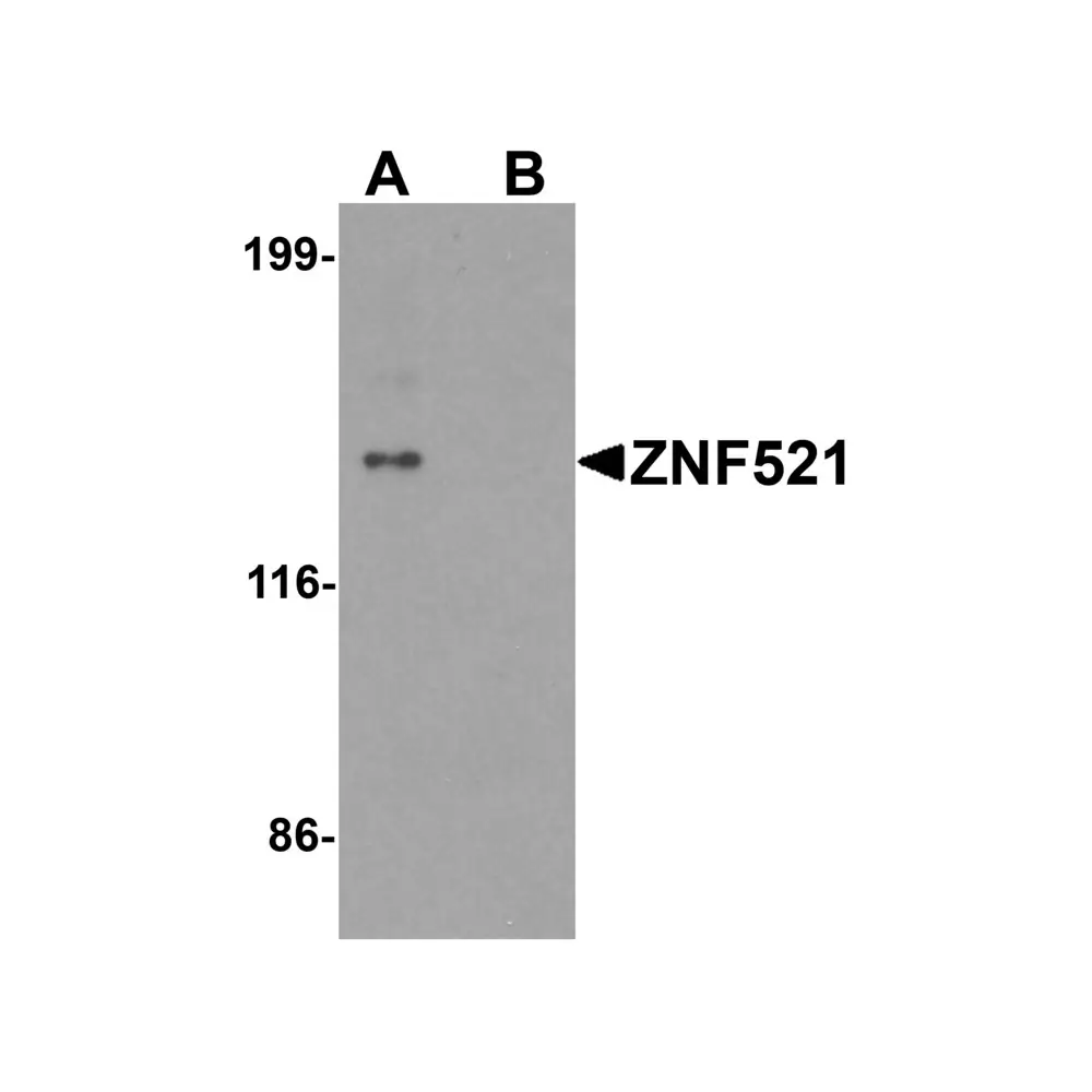 ProSci 6859 ZNF521 Antibody, ProSci, 0.1 mg/Unit Primary Image
