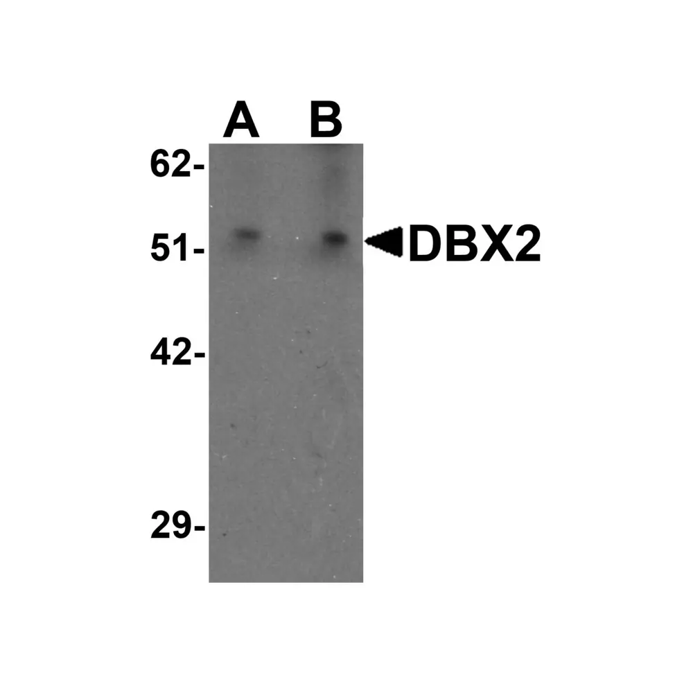 ProSci 6873 DBX2 Antibody, ProSci, 0.1 mg/Unit Primary Image